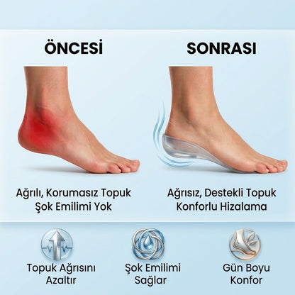 Topuk Dikeni ve Plantar Fasiit Ağrılarına Son!